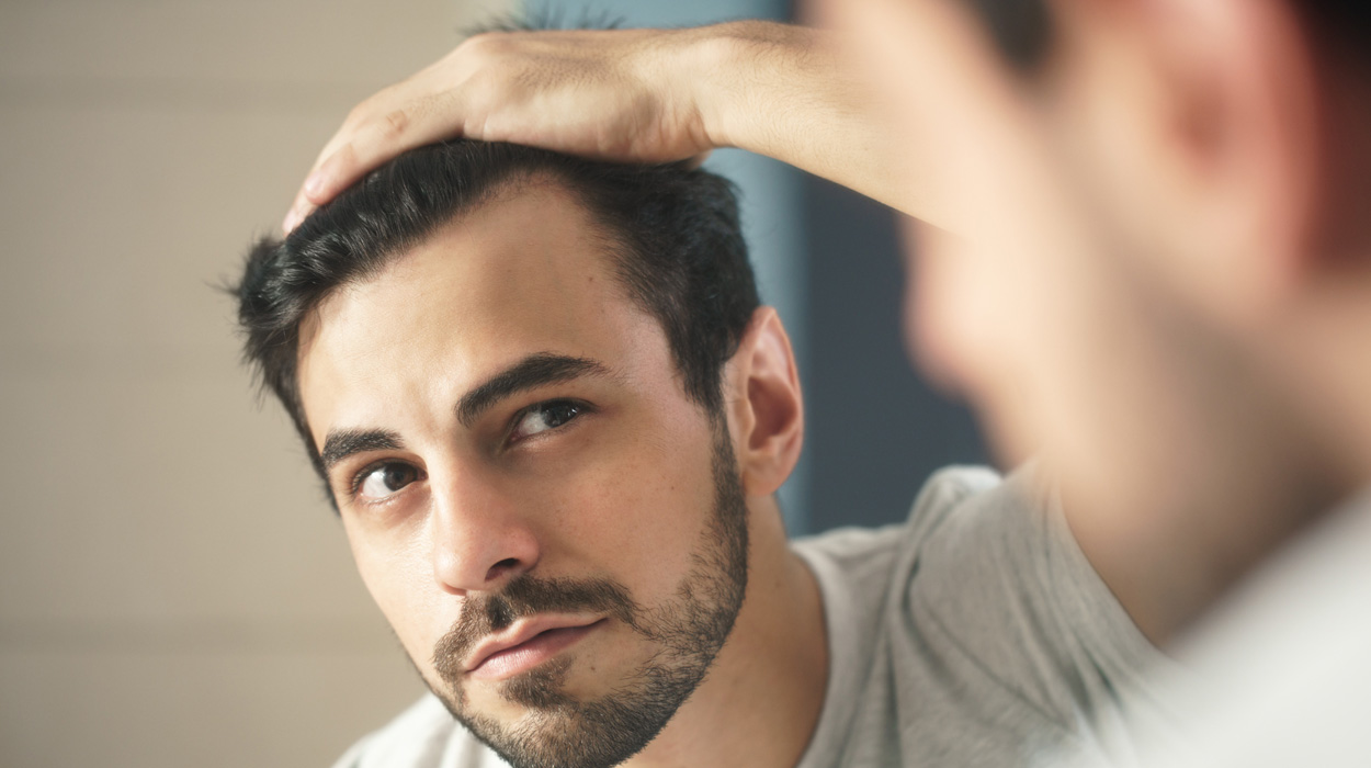 Client seeking treatment of receding hairline.