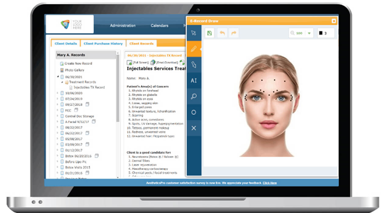 AestheticsPro EMR on computer screen - electronic record using real photo and mark-up